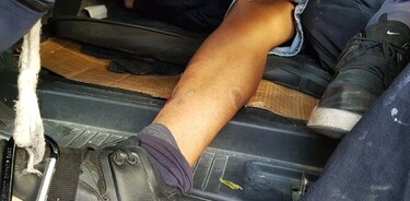 Aumenta la cifra de heridos en Venezuela