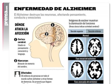 Crean espacio virtual a favor de la investigación sobre el alzheimer