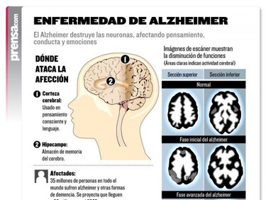 Crean espacio virtual a favor de la investigación sobre el alzheimer