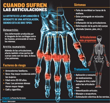 Poco se sabe de la artritis