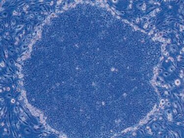 Células madre crecen como neuronas