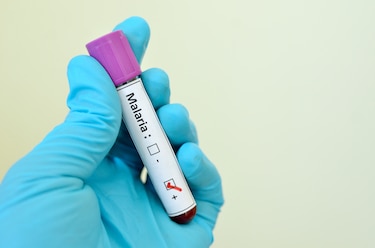 Los tres factores que están impulsando la malaria desde el punto de vista científico