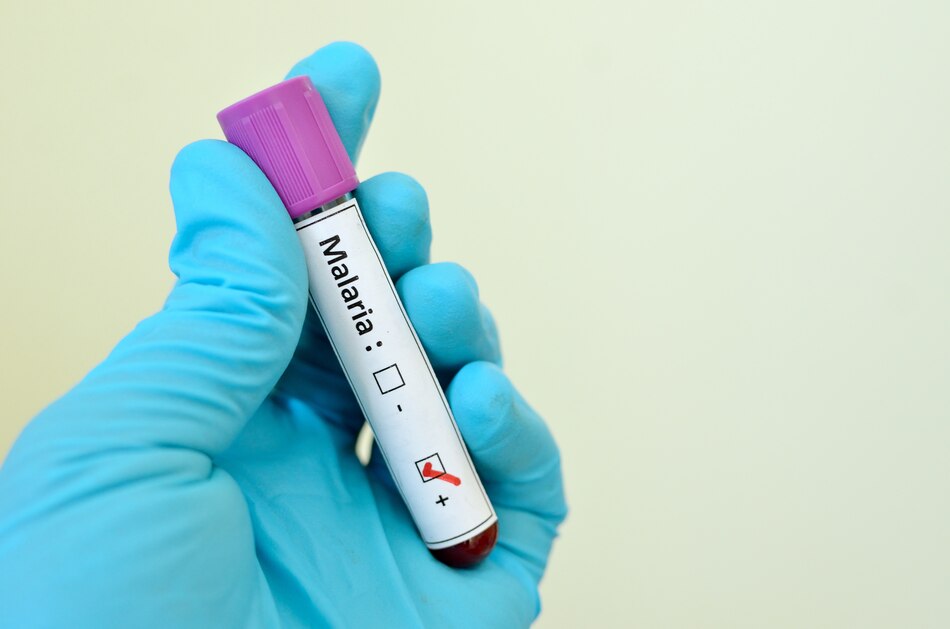 Los tres factores que están impulsando la malaria desde el punto de vista científico