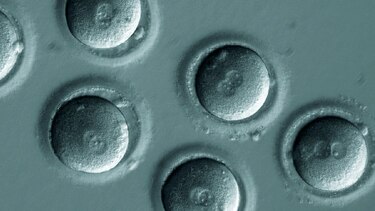 Edición genética y sus desafíos