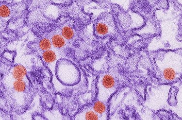 Riesgo de zika por relaciones sexuales duraría un mes