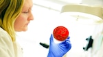 Discuten sobre resistencia a los antimicrobianos