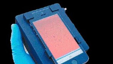 ‘CellScope Loa’ podría ayudar a eliminar enfermedades