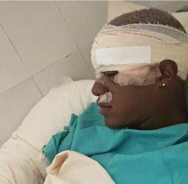 Futbolista panameño herido en accidente de tránsito en Bolivia