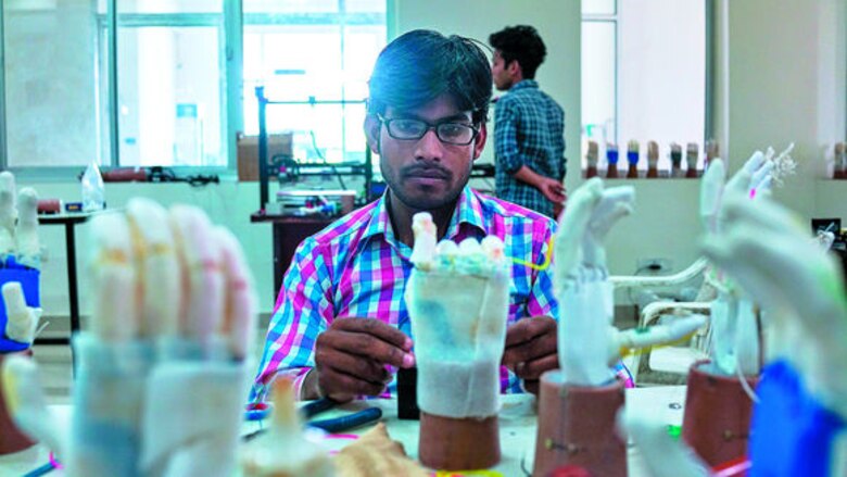 Alivio gracias a prótesis de bajo costo