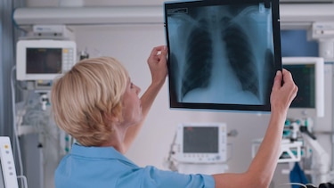 (Actualizada: 1)Qué es un adenocarcinoma pulmonar, el tipo de tumor maligno que le extirparon al papa León XIV