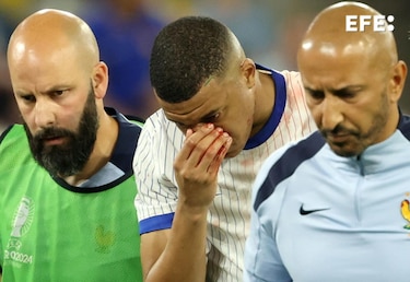 Mbappé sufre una lesión en la nariz, pero no será operado