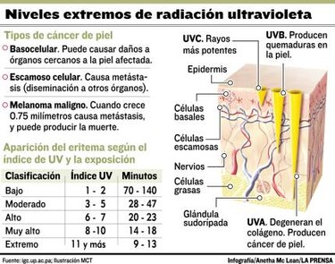 Días de alta radiación en el país1000279