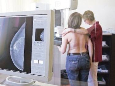 8 mitos del diagnóstico del cáncer