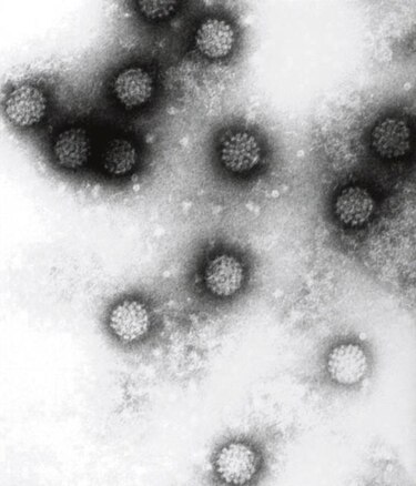 Comité asesor de los CDC en EU aconseja usar vacuna contra VPH en varones