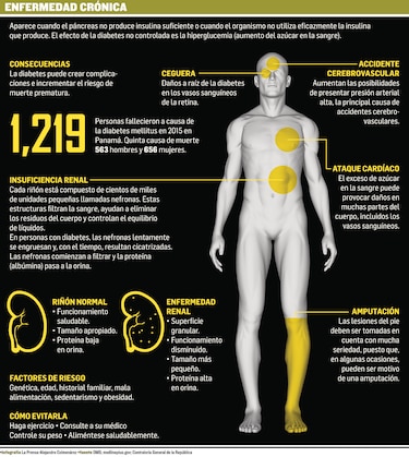 Diabetes, una enfermedad silenciosa y degenerativa