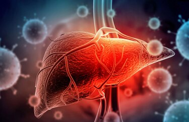 El 78% de los casos de cáncer primarios de hígado son causados por los virus de la hepatitis B y C