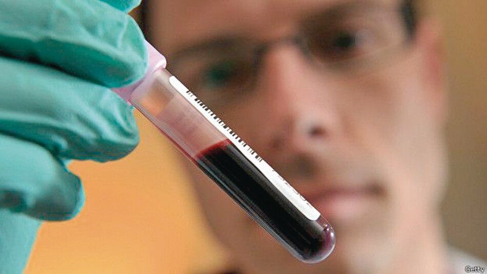 Estudio confirma la alta prevalencia de sífilis en pacientes con VIH en Panamá