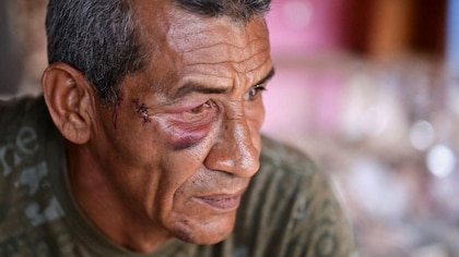 Hablan los sobrevivientes del ataque con misil al Bloque 12, el edificio donde murió una mujer durante el bombardeo de Estados Unidos a Venezuela