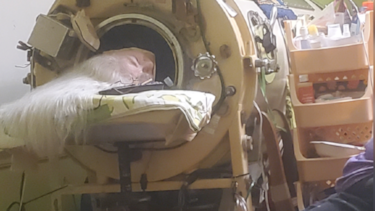 La mujer que vivió 73 años metida varias horas al día en un pulmón de acero que le permitía respirar