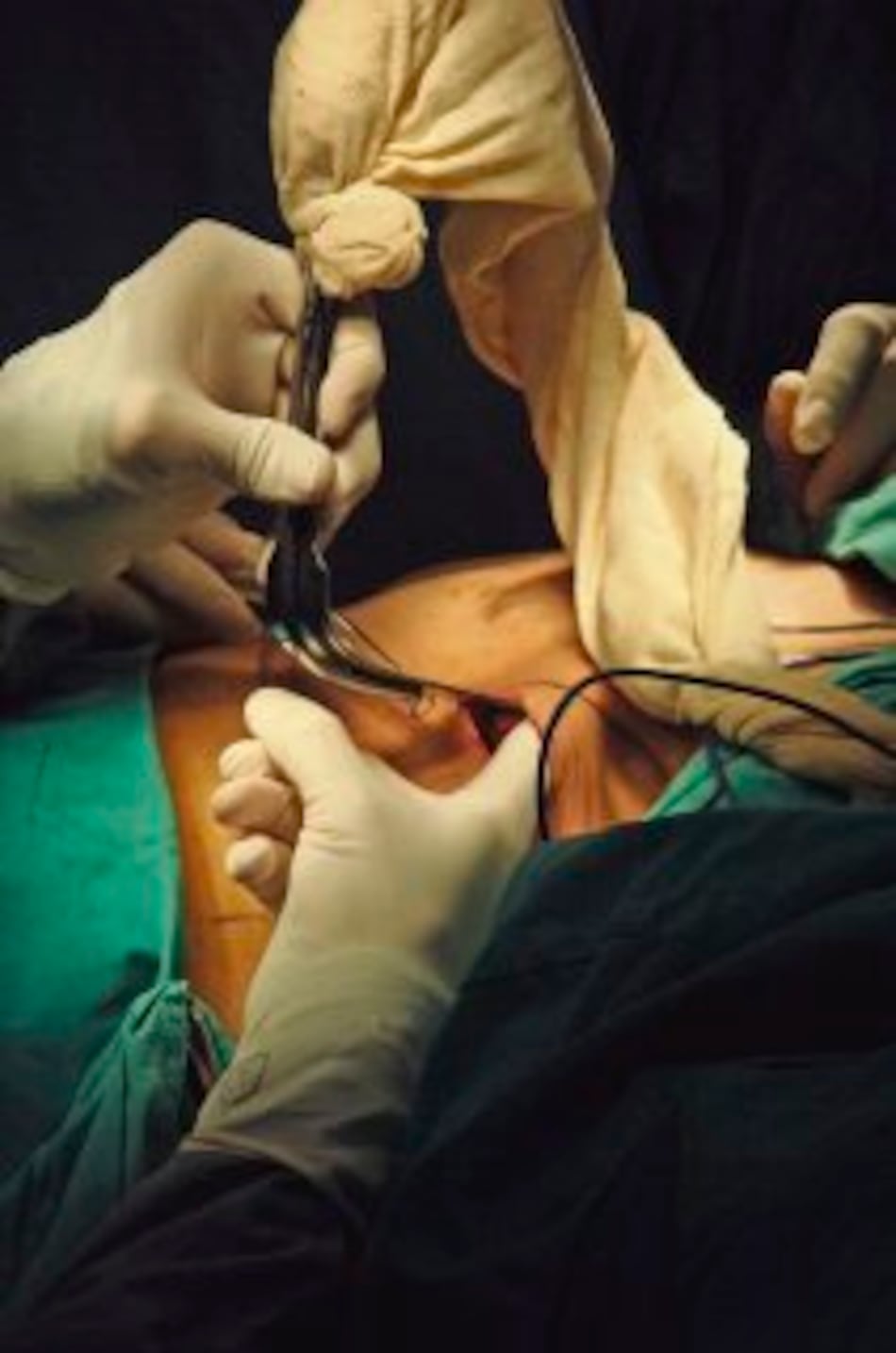 Se incrementan las cirugías en el Instituto Oncológico Nacional