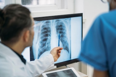 Los médicos del Papa informan que camina y se recupera tras su cirugía por un cáncer de pulmón