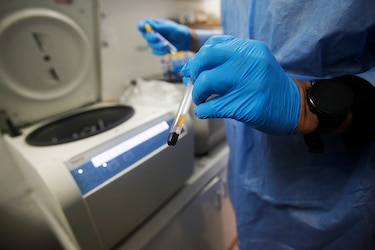 Estados Unidos aprueba la primera inyección preventiva para el VIH aplicada cada seis meses