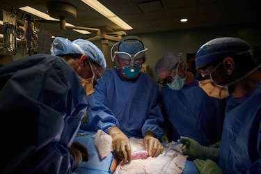 Trasplantan por primera vez riñón de puerco genéticamente modificado en un humano