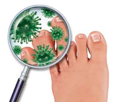 10 mitos sobre los hongos en uñas y piel