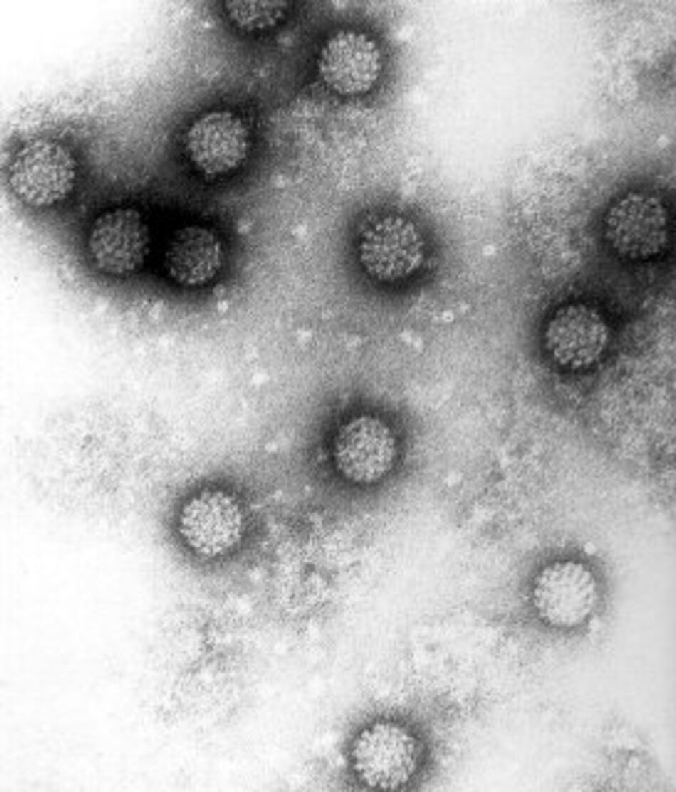 Identifican ocho virus