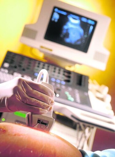 Más de 215 millones de mujeres no tienen acceso al control de natalidad