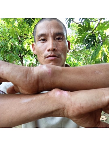 Bocas del Toro: el dolor y las cicatrices que dejó la Operación Omega