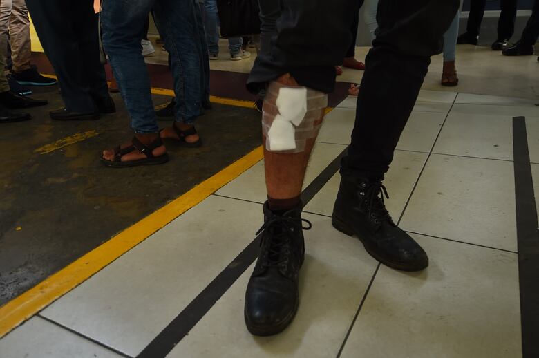 'A un muchacho le rompieron la pierna a toletazos', un relato desde el corazón de la protesta contra las reformas