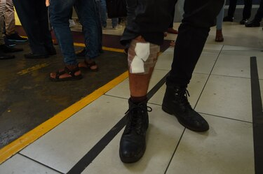 'A un muchacho le rompieron la pierna a toletazos', un relato desde el corazón de la protesta contra las reformas