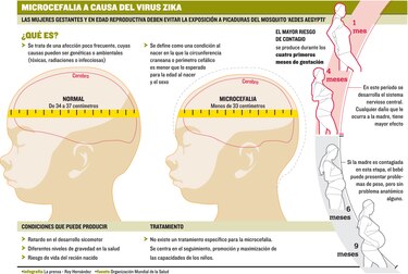 El zika amenaza disparar abortos