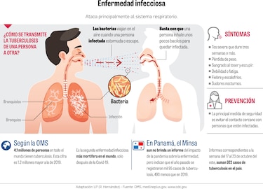 Pandemia de la Covid-19 dificulta  la lucha contra la tuberculosis 
