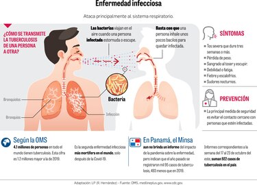 Pandemia de la Covid-19 dificulta la lucha contra la tuberculosis