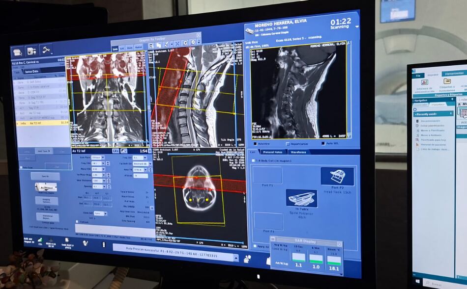 Pacientes en lista de espera: 7,311 estudios de resonancia sin realizar en la CSS