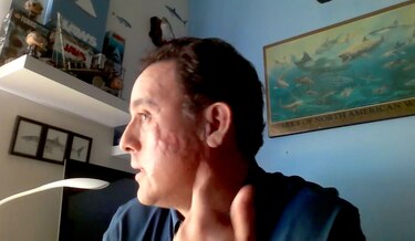 ‘Me perdonó la vida’: el relato del mexicano que sobrevivió a la mordida de un tiburón en la cabeza
