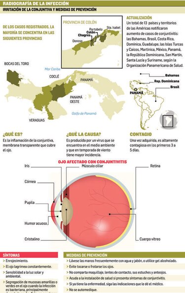 Reportan 60 mil 375 casos de conjuntivitis desde agosto