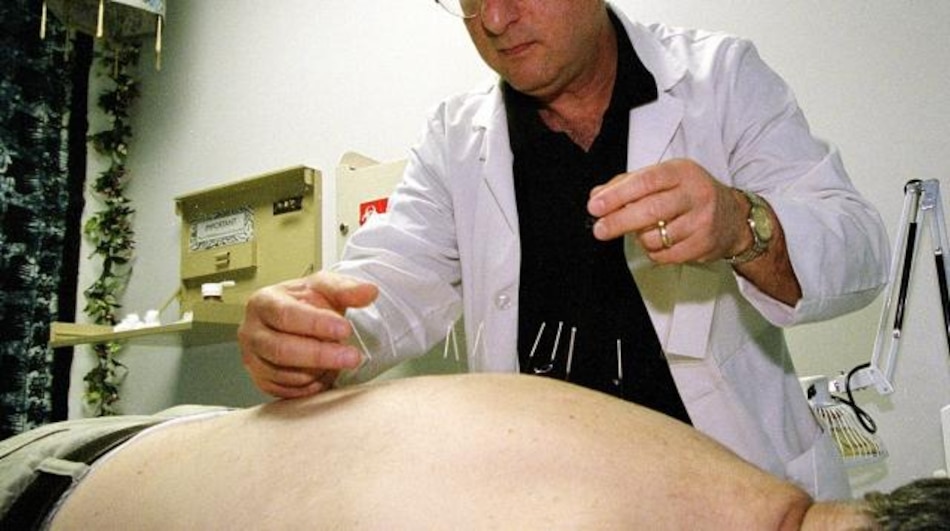 China presenta nuevos protocolos para tratamiento de acupuntura