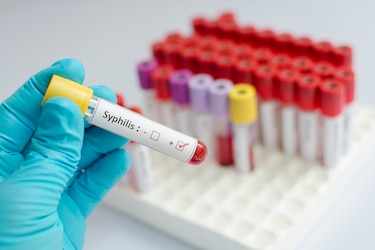 Sífilis, una infección sexual que gana terreno en las Américas, incluyendo Panamá