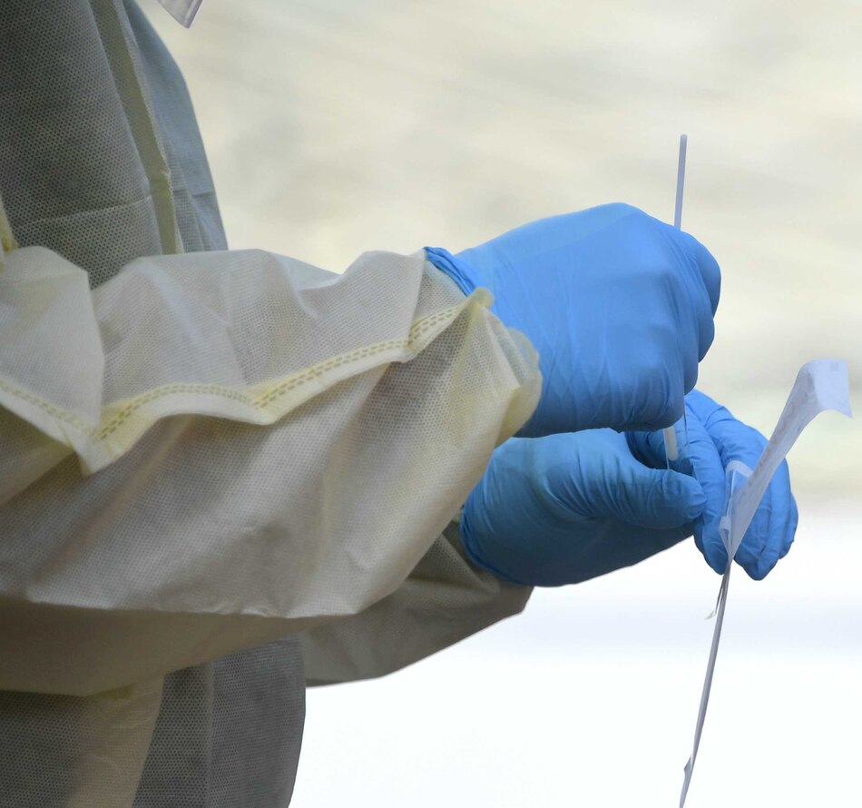 Minsa reporta 154 nuevos contagios de la covid-19 en una semana, la positividad fue de 5.4%