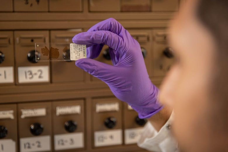 Cómo son los cerebros de los ‘superancianos’