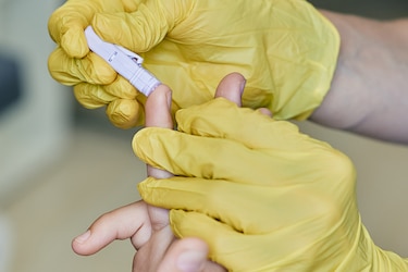 Minsa busca capacitar personal en pruebas rápidas de VIH; laboratoristas están en alerta