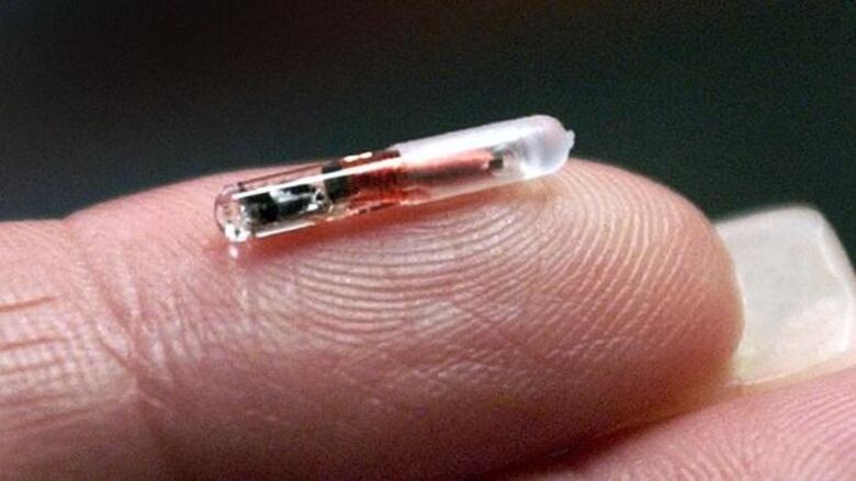 Ya es una realidad: Empresa sueca inyecta microchips a empleados para monitorearlos