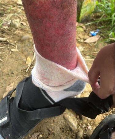 Maestro de la comarca Ngäbe Buglé necesita traslado urgente a una instalación de salud