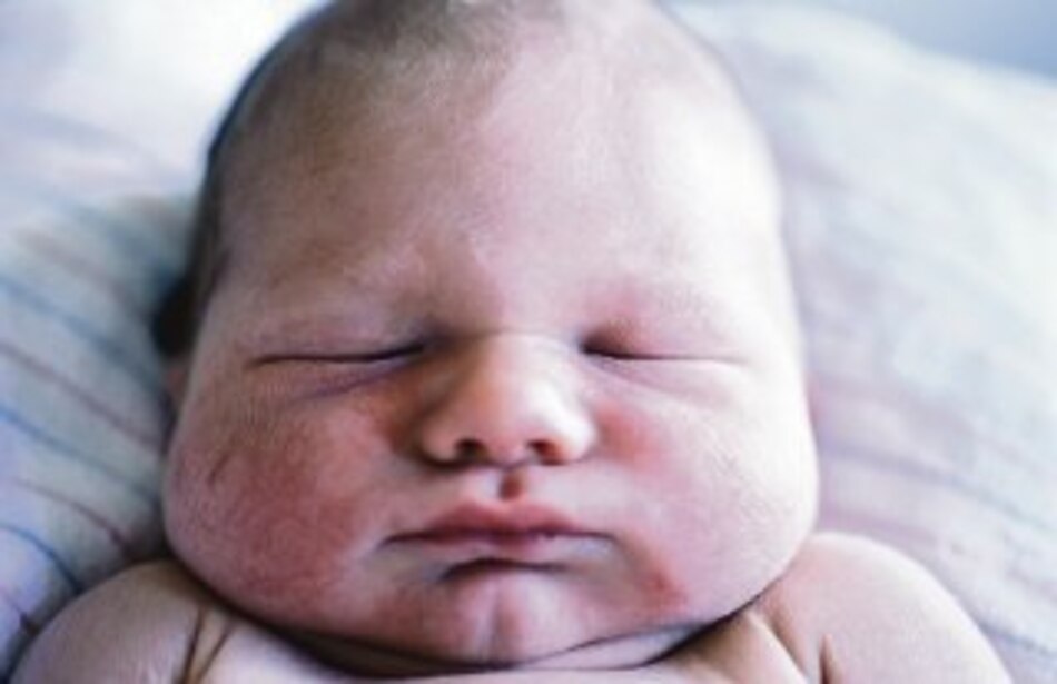 Bebés gorditos, adultos enfermos