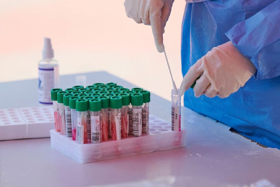 Se registran 1,584 nuevos contagios de la covid-19; la positividad disminuye a 14%