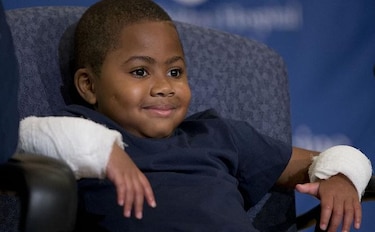 Niño de 8 años recibe doble trasplante de mano