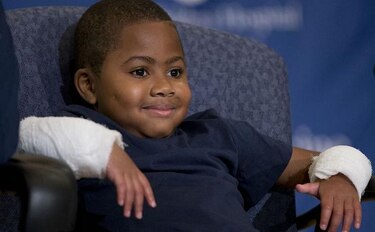 Niño de 8 años recibe doble trasplante de mano